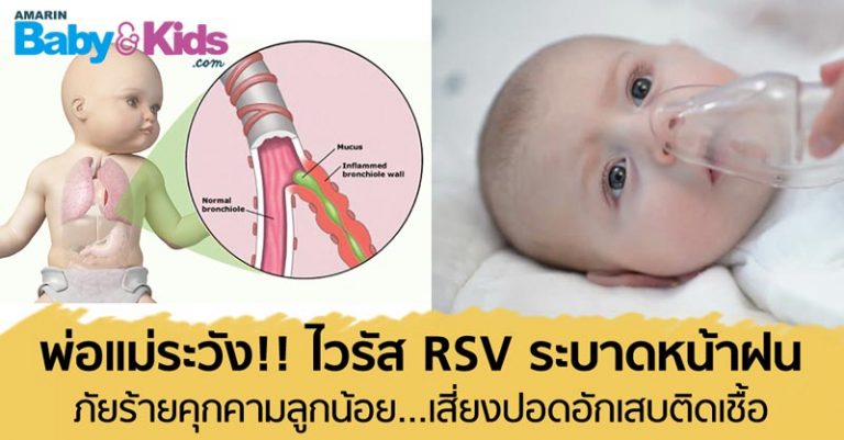 RSV โรคติดเชื้อทางเดินหายใจในเด็ก