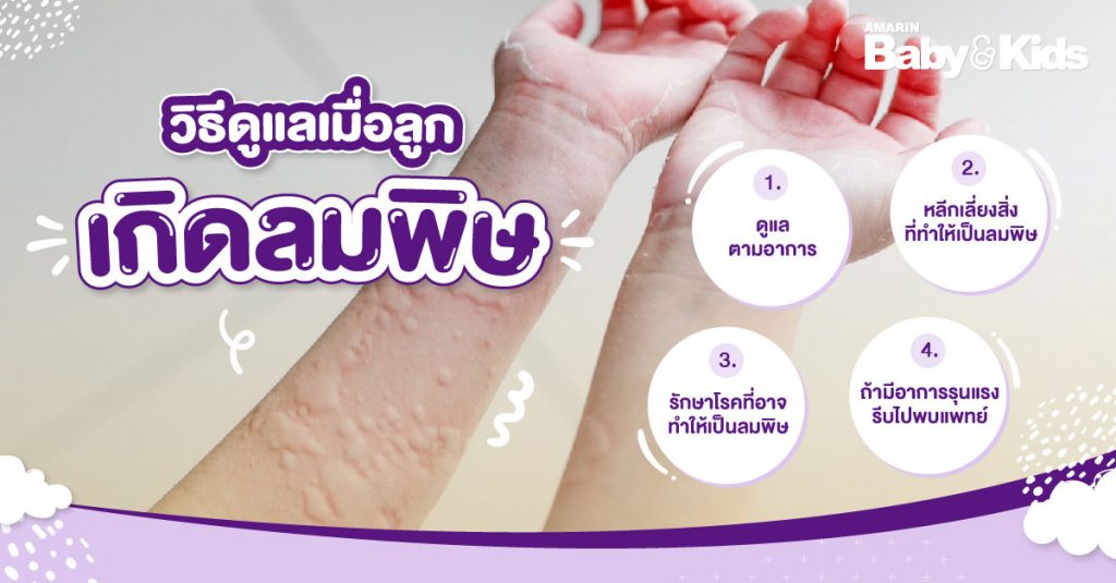 การดูแลลูกน้อย เมื่อลูกมีอาการของโรคลมพิษในเด็ก
