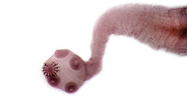 Taenia solium