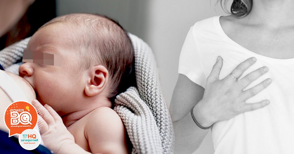 ให้นมลูกแต่เจอ ก้อนที่เต้านม ควรทำอย่างไร อันตรายไหม? Amarin Baby & Kids