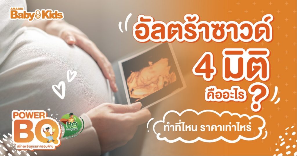 อัลตร้าซาวด์ 4 มิติ