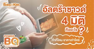 อัลตร้าซาวด์ 4 มิติ