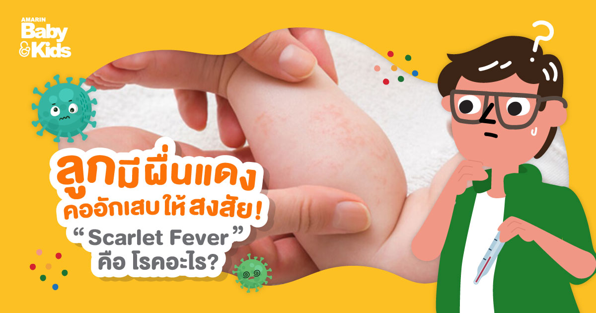 scarelet fever โรคไข้อีดำอีแดง